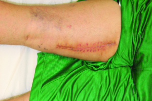 photo-4-1-e1412642493978-300x200